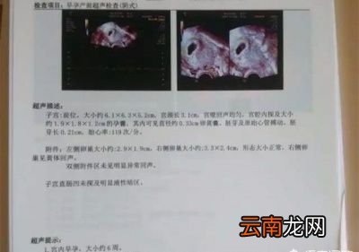 怀孕后什么时候次去医院检查比较合适