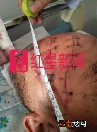 防卫过当致人死亡要怎么判 防卫过当致人死亡要判几年