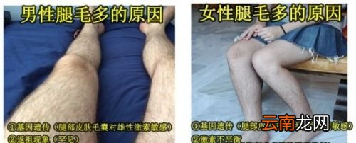 腿毛多的男人代表什么