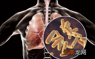 如何判定自己是不是无症状感染者
