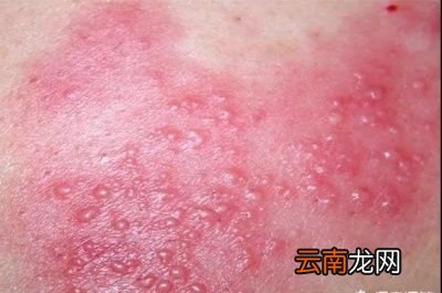 →病毒感染如何影响我们的健康
