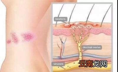 →病毒感染如何影响我们的健康