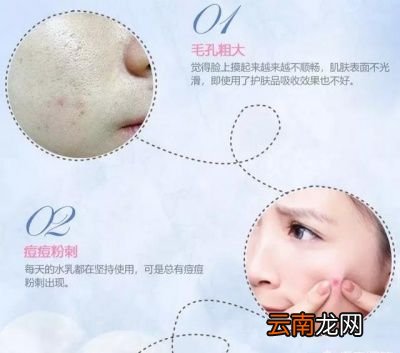 为什么要去角质呢