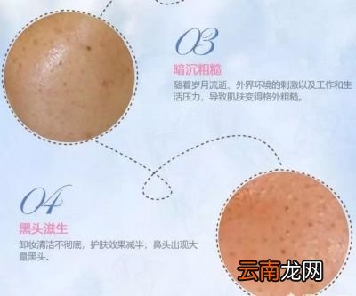 为什么要去角质呢