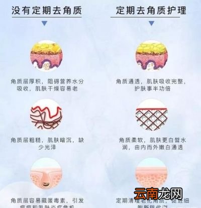 为什么要去角质呢