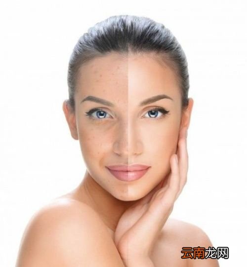 下巴的硬疙瘩是怎么消