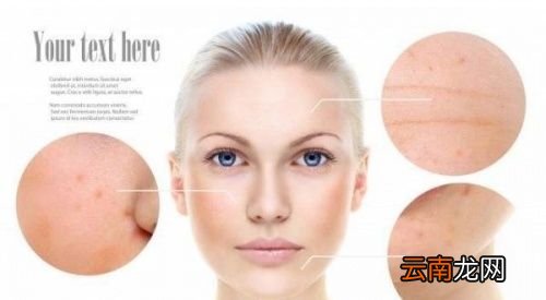 下巴的硬疙瘩是怎么消