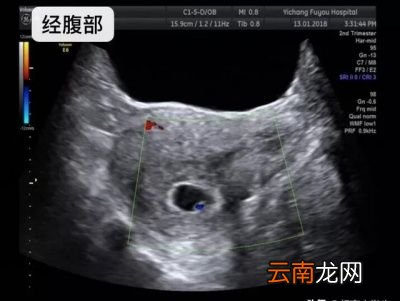 做阴超有什么好