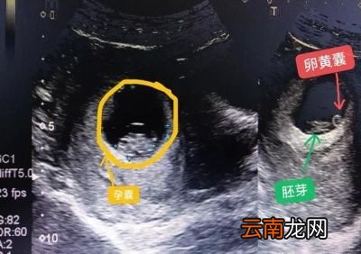 做阴超有什么好