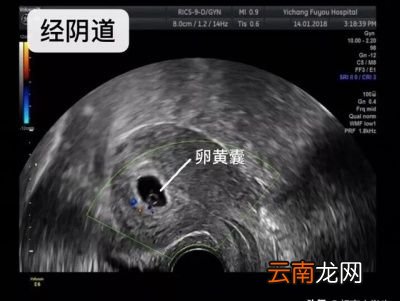 做阴超有什么好