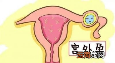 为什么要做「阴超」