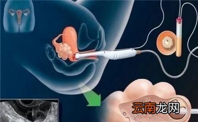 为什么要做「阴超」