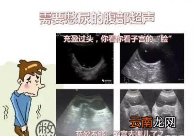 为什么要做「阴超」