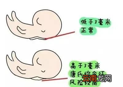 孕期12周可以去医院建档了吗