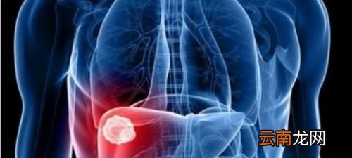 放屁多是肝病的前兆吗