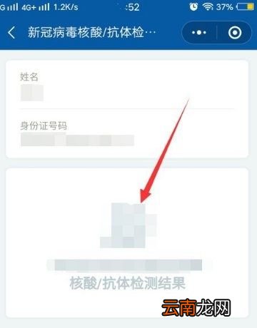 核酸检测的结果怎样是正常的