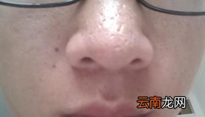 男性湿气重应该怎么排除湿气