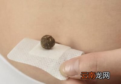 湿气重怎么排湿呢