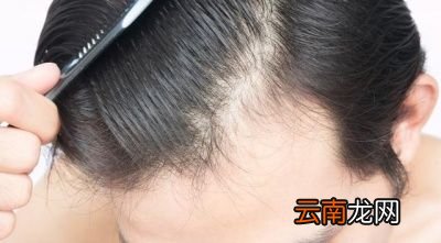 湿气重怎么排湿呢