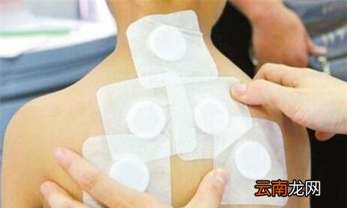 三伏贴最好什么时间贴