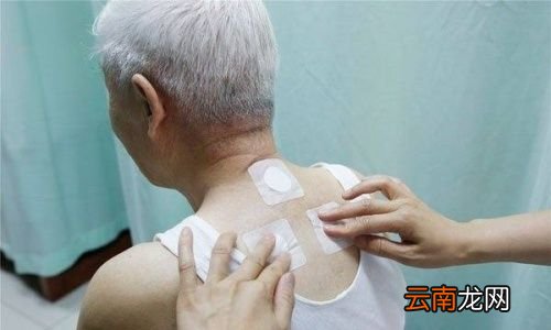 三伏贴最好什么时间贴