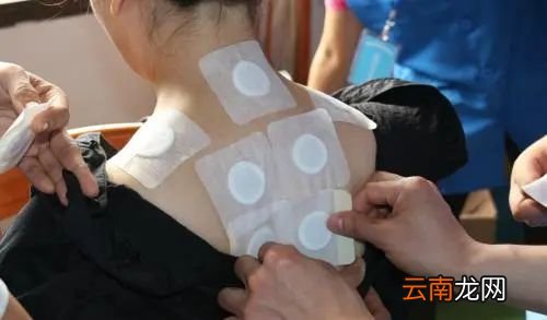 什么人不适合用三伏贴