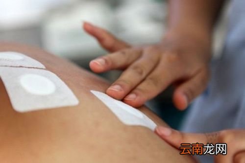 什么人不适合用三伏贴