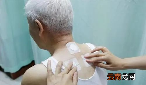 什么人不适合用三伏贴