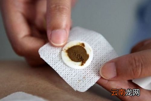 什么人不适合用三伏贴