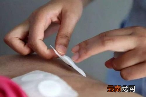 什么人不适合用三伏贴