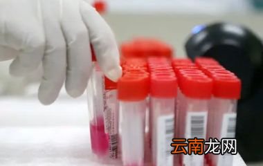健康码有灰码吗