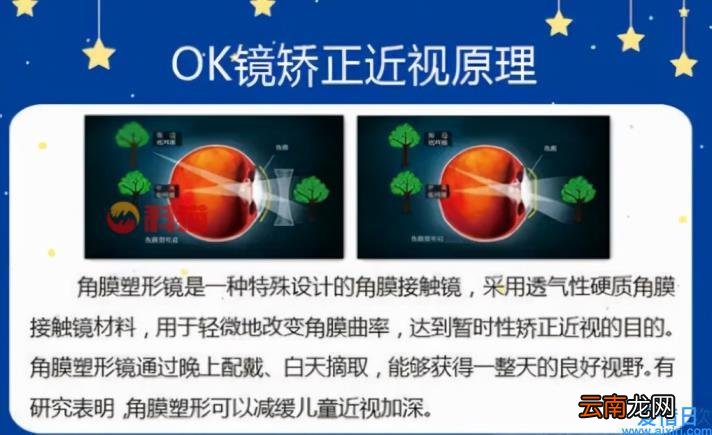 一副ok镜多少钱 ok镜适合多大的孩子