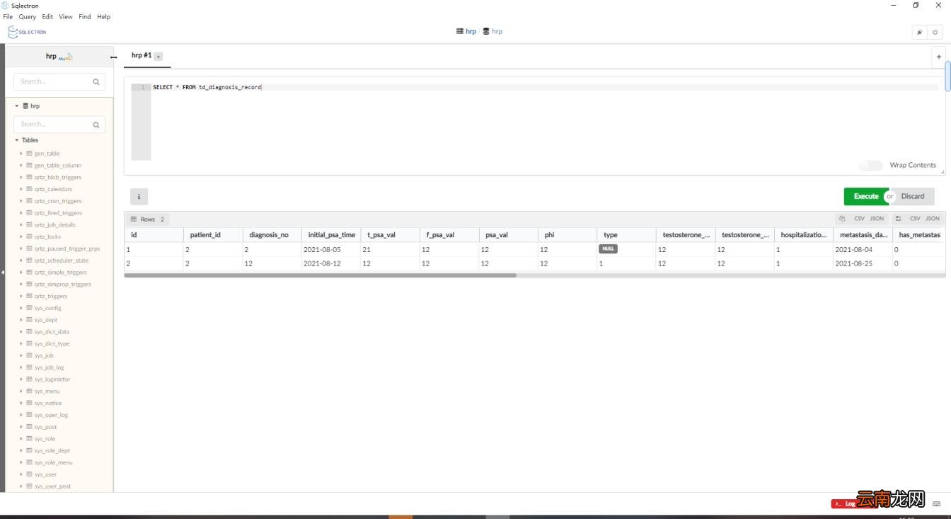 sqlserver连接工具有哪些 数据库连接工具推荐