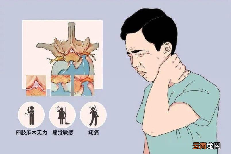 重庆看颈椎病较好的医院？重庆红楼医院骨科口碑好疗效快
