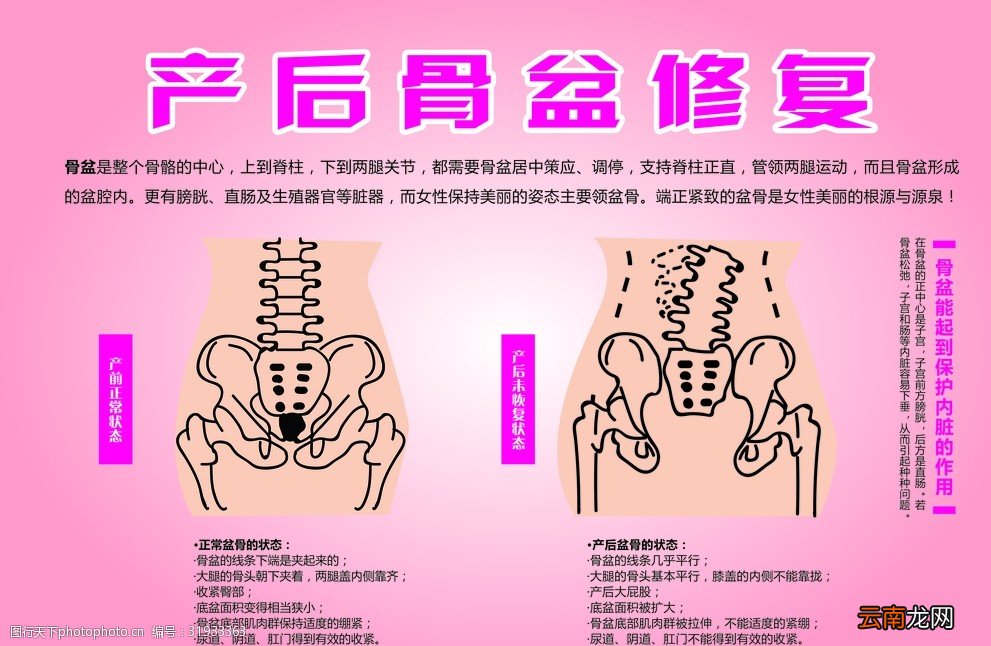 产后修复