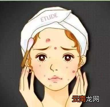 额头长痘痘是什么原因怎么调理