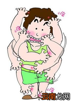 荨麻疹可以吃什么食物