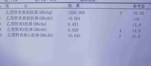 乙肝怎么检查