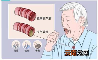 支气管炎一般多久自愈