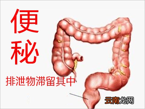 治疗便秘的最佳方法