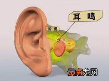 神经性耳鸣治疗的最佳方法