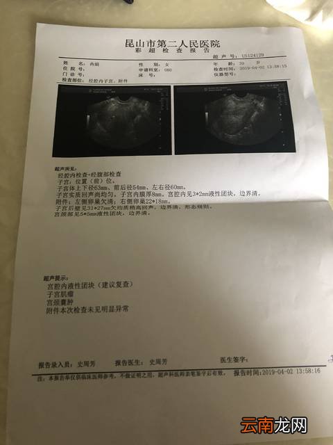 血块和孕囊的区别图