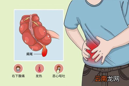 阑尾在什么位置