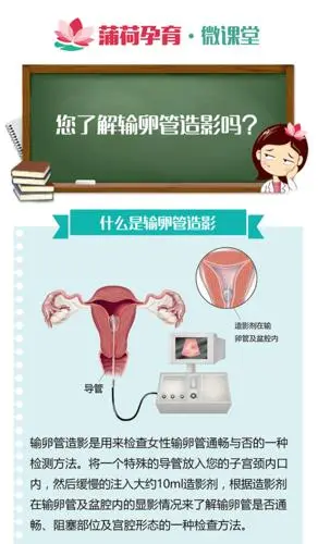 输卵管造影检查痛苦吗