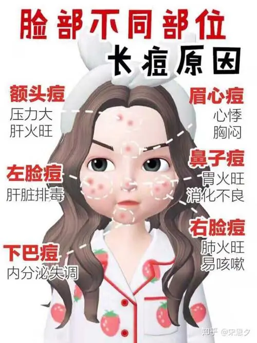 长痘痘的位置图解