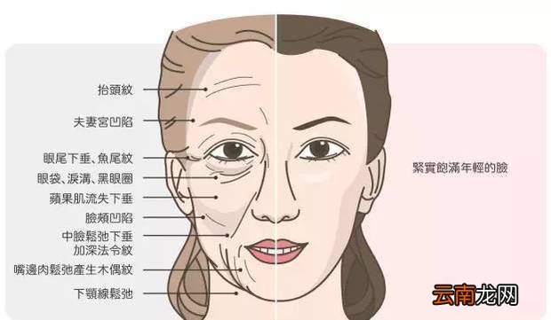 法令纹是哪里 法令纹是指什么