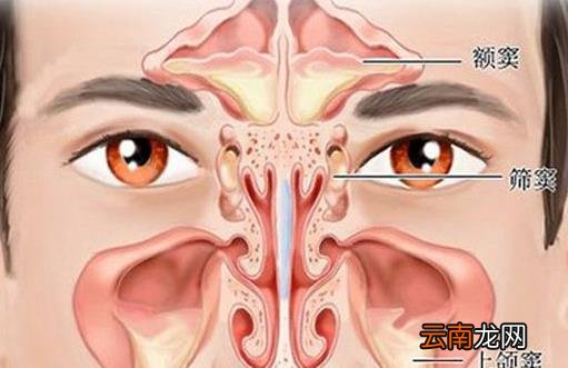 鼻炎怎么治疗可以根除