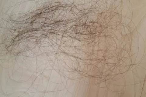 梦见自己掉头发是什么意思