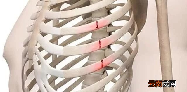 右侧肋骨下隐痛是怎么回事