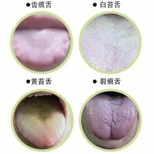 舌苔白又厚是怎么回事